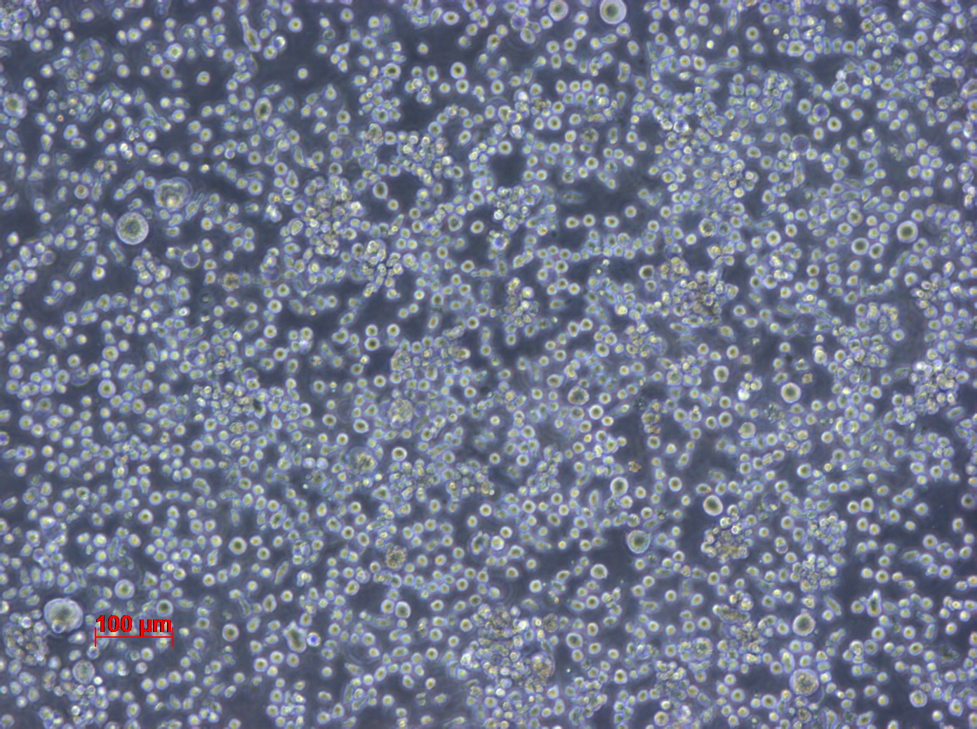 HEL 92.1.7细胞图片